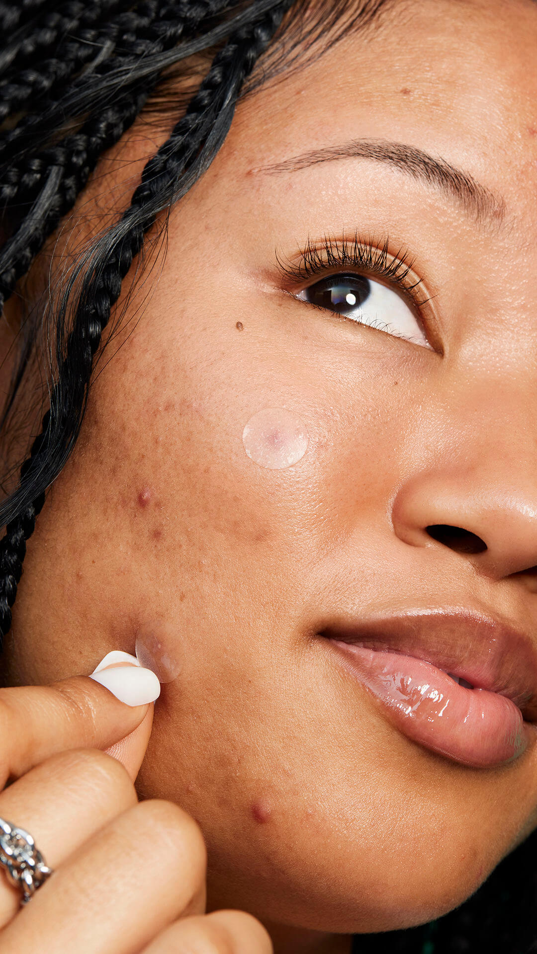 SOME BY MI - 30 days Miracle Clear Spot Patch